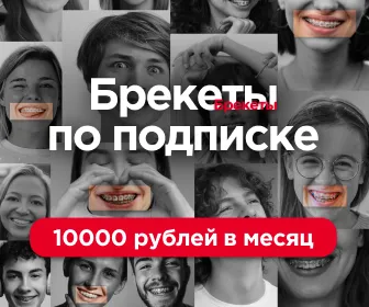 Рекламный баннер: брекеты