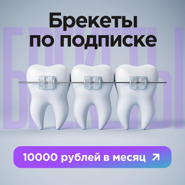 Рекламный баннер: брекеты, VK